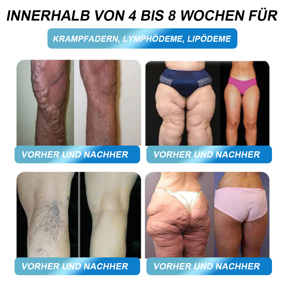 Die einzige offiziell von der BfArM zugelassene | DOCTɪA®👨⚕️6-in-1 Oral-𝑳öѕ𝒖𝒏𝒈 (nur 1 Dosis pro Tag, sichtbare Ergebnisse in 7 Tagen)💎Für Adipositas, Herz-Kreislauf-Gesundheit, Diabetes, Schlafapnoe, Gelenkprobleme u.v.m