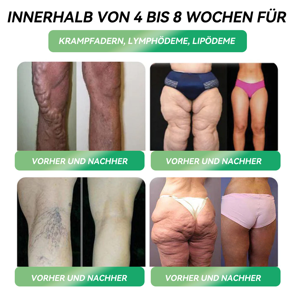 𝑶𝒇𝒇𝒊𝒛𝒊𝒆𝒍𝒍𝒆𝒓 𝑺𝒉𝒐𝒑 | 𝐇𝗛𝑉𝖡® 🧑⚕️𝑶𝒓𝒂𝒍𝒆 𝑮𝑳𝑷-1-𝑳𝒐̈𝒔𝒖𝒏𝒈 𝒛𝒖𝒓 𝑮𝒆𝒘𝒊𝒄𝒉𝒕𝒔𝒂𝒃𝒏𝒂𝒉𝒎𝒆💎Bereits nach einer Woche – sichtbare Veränderungen in 7 Tagen Für Adipositas, Herz-Kreislauf-Gesundheit, Diabetes, Schlafapnoe, Gelenkprobleme und mehr